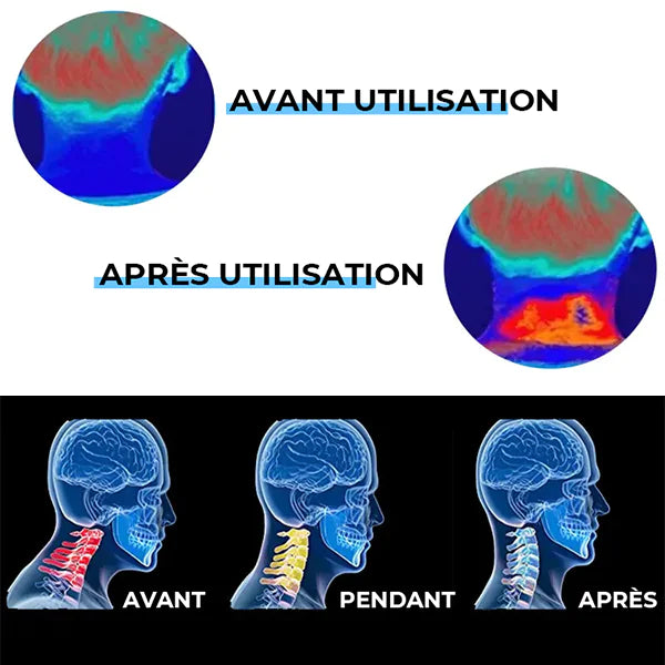 Cervical Chiropractic Traction Device