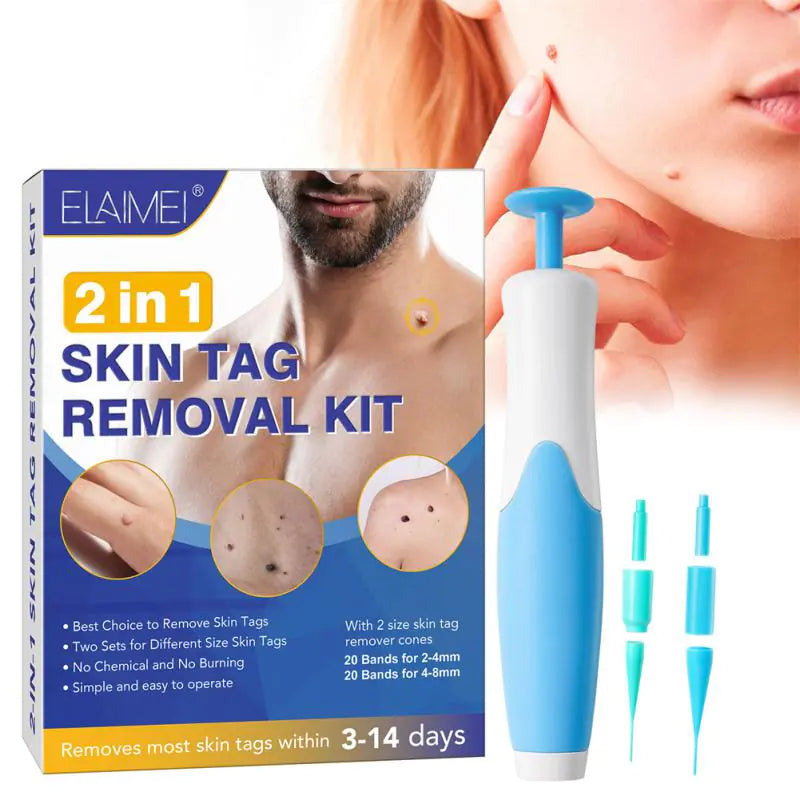 Skin Tag Removal Kit